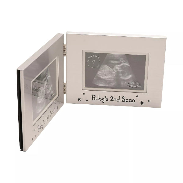 Open photo album with ultrasound images and 'Baby's 2nd Scan' text on a white background